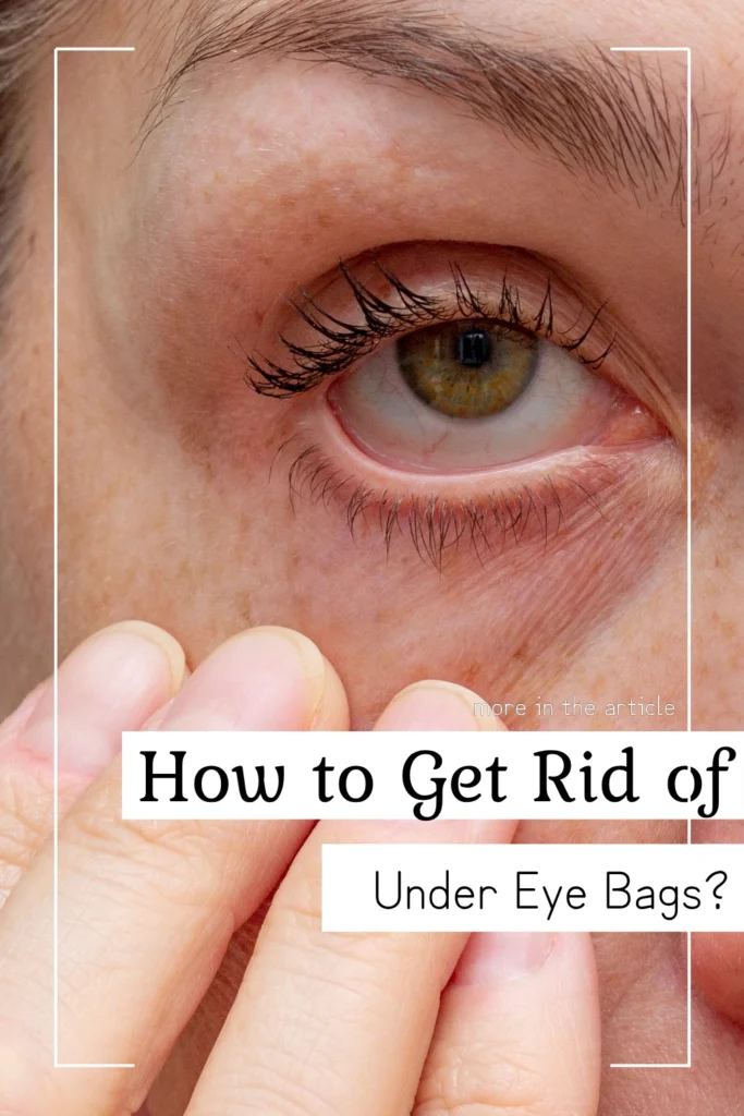 How to Get Rid of Under Eye Bags